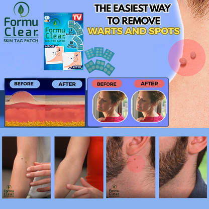 Formu Clear Skin Tag