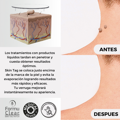 Formu Clear Skin Tag