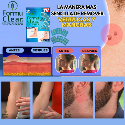 Formu Clear Skin Tag